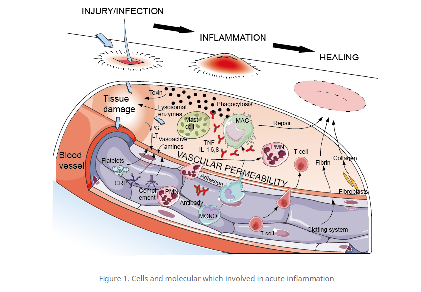 CBD Helps with Inflammation