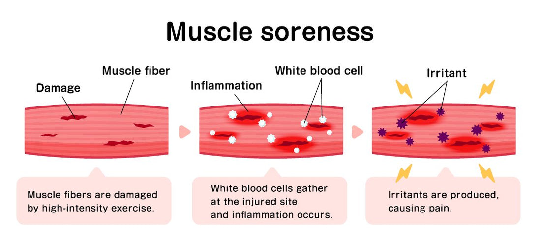 How to Reduce Muscle Inflammation Naturally: An Athlete’s Guide to Recovery