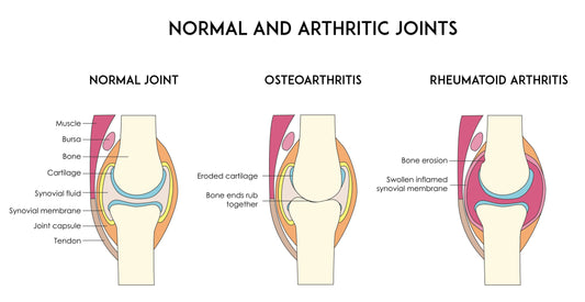 Fight Arthritis with Gameday CBD